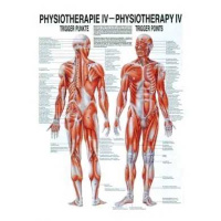 anatomische Poster: Physiotherapie Triggerpunkte, 50 x 70...