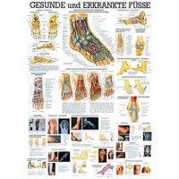 anatomische Lehrtafel: Gesunde und erkrankte...