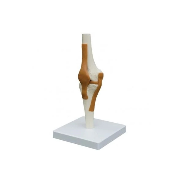 Luxus Kniegelenk rechts, auf Sockel