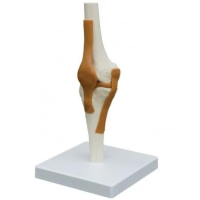 Luxus Kniegelenk rechts, auf Sockel