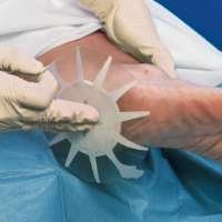 Tegaderm Foam, 20x20cm, 5 quadratisch, nichtklebend