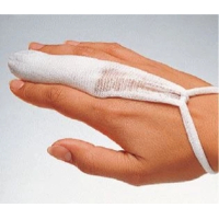 tg-Fingerling 50 St&uuml;ck