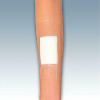 Iodosorb Dressing 4x6cm 5g antis. Wundverband steril  5...