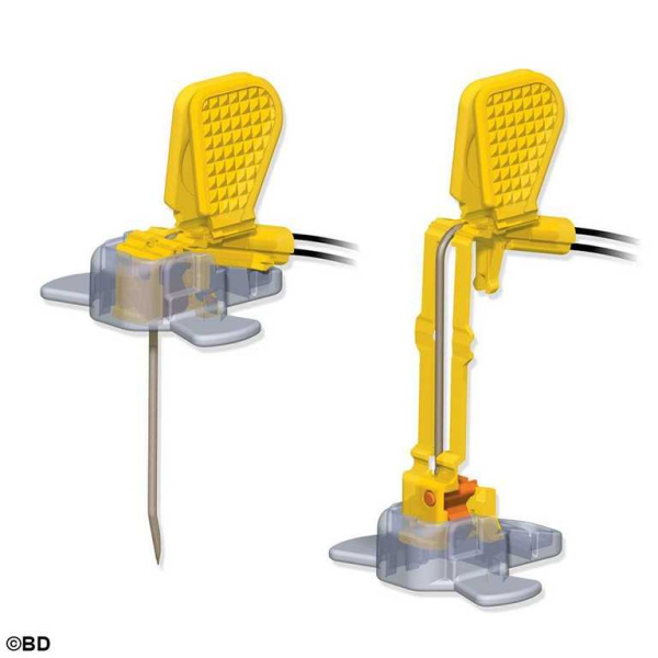 MiniLoc Sicherheitsinfusionsset ohne Y-Adapter 19 G x 12,7 mm 20 Stück