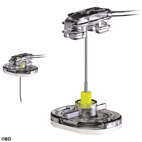 SafeStep Huber Nadelset zur Portpunktion ohne Y-Adapter, 19 G 25 mm 25 Stück