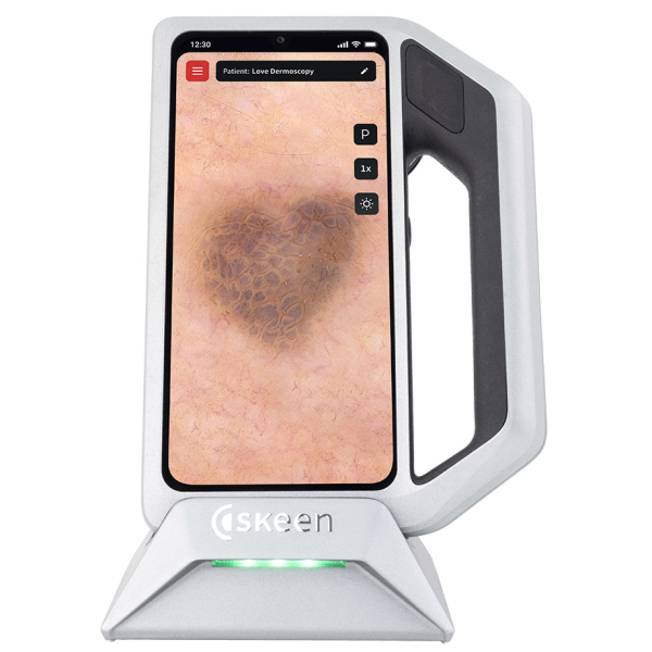FotoFinder skeen Professionelles Dermatoskop für Dermatologie und Hautscreening